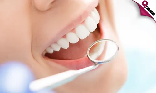 Teeth Whitening + Consultation + Scaling + Polishing!